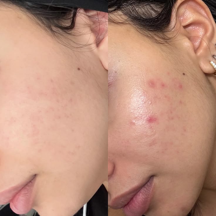 NIACI+ COLÁGENO — Sérum Facial Niacinamida + Colágeno